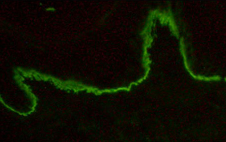 Immunofluorescence