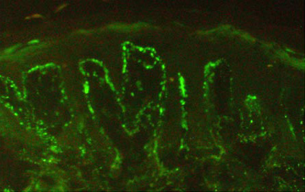 Immunofluorescence