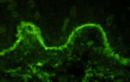 Immunofluorescence