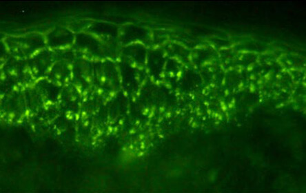 Immunofluorescence