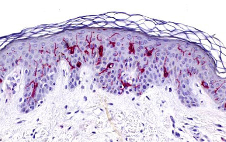 Immunoperoxidase