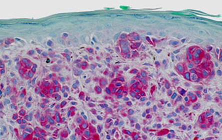 Immunoperoxidase