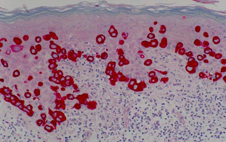 Immunoperoxidase