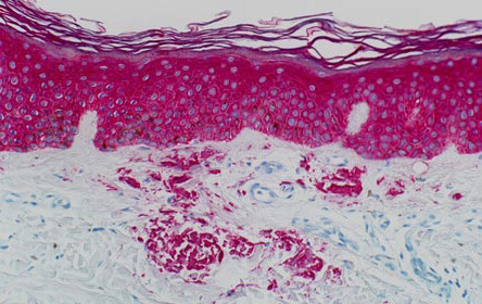 Immunoperoxidase