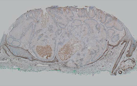 Immunoperoxidase