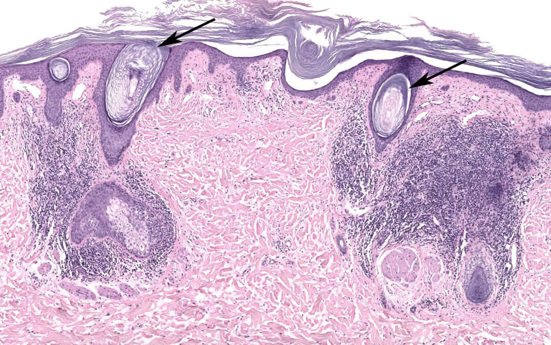 Histology and Histochemistry