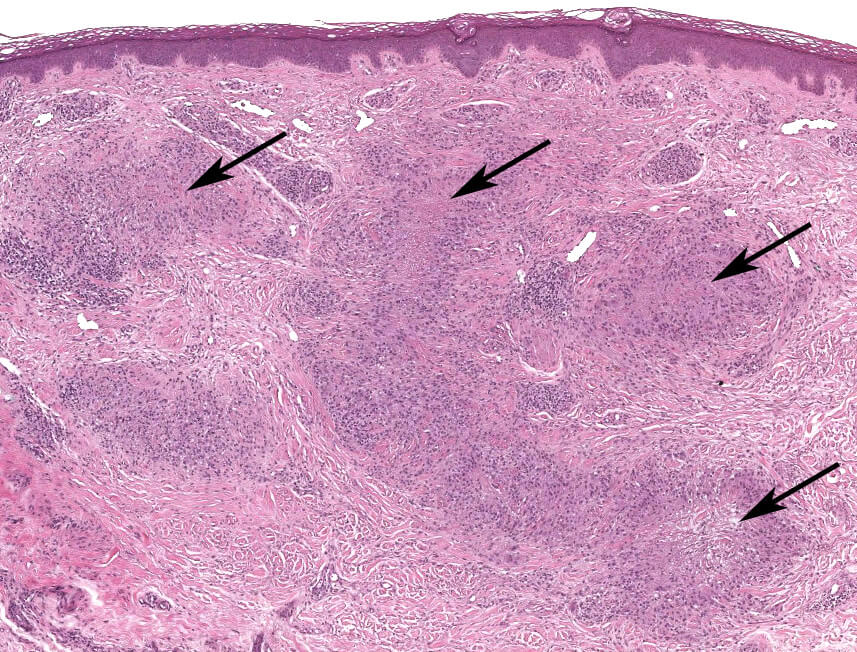 Histology and Histochemistry