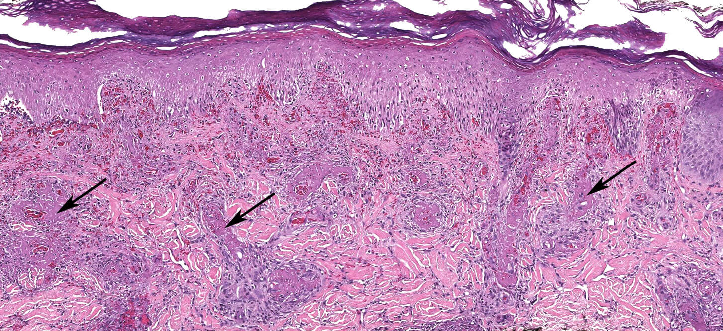 Histology and Histochemistry