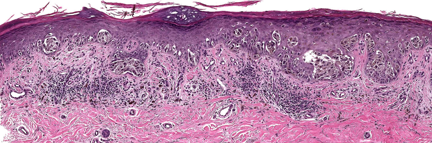 Histology and Histochemistry