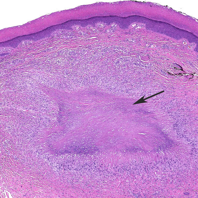 Histology and Histochemistry